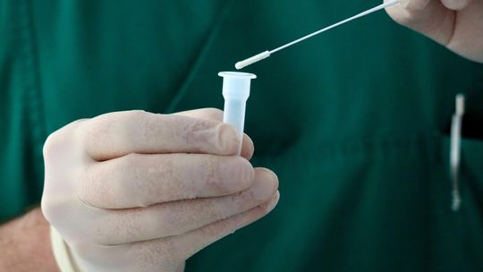 Zidentyfikowano gen odpowiedzialny za ryzyko ciężkiego Covid-19; powstanie test dla pacjentów