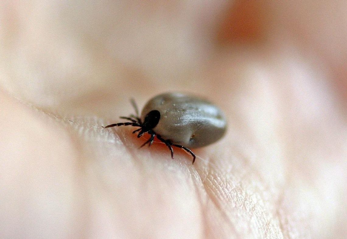 Usunąłeś kleszcza ze skóry? Naukowcy UW mogą zbadać go pod kątem krętków boreliozy